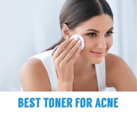 Best Toner for Acne Philippines