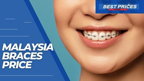 Guide to Malaysia Braces Price 2024 - Affordable Dental Braces